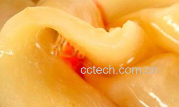 鱼胶对女性的功效-0