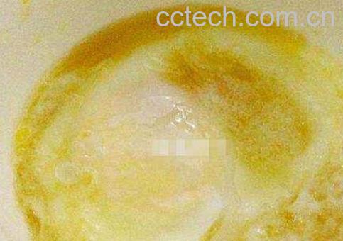 白糖蒸蛋的功效与作用-0