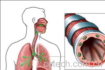 果蔬百科支气管炎-0