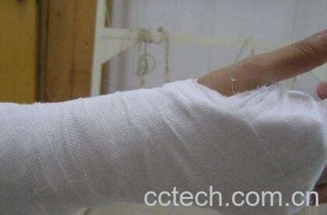 八仙接骨宝的配方与功效-0