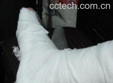 八仙接骨宝的配方与功效-1