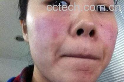 海棠花粉过敏-1