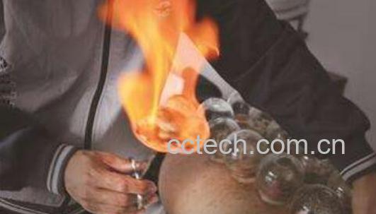 拔火罐的好处和坏处 拔火罐要注意什么-0