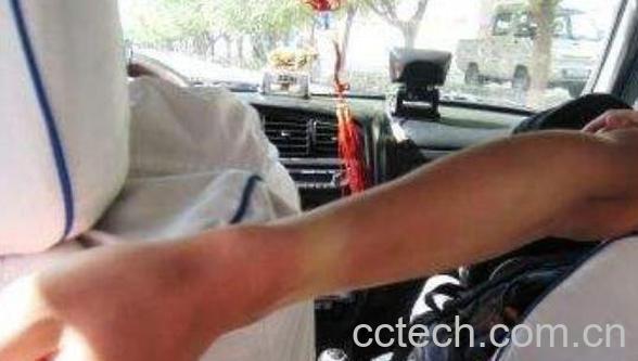 晒伤后怎么处理 晒伤后如何修复-1