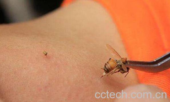 蜜蜂蛰了怎么办 蜂子蜇了最快消肿止痛的方法-1