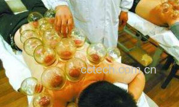 拔火罐有什么好处 拔火罐的好处介绍-1