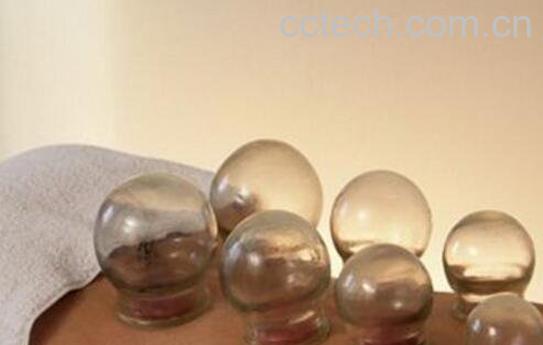 如何拔火罐 什么样的人需要拔血罐-0