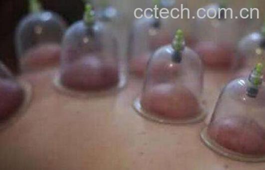 拔血罐的好处和坏处-1