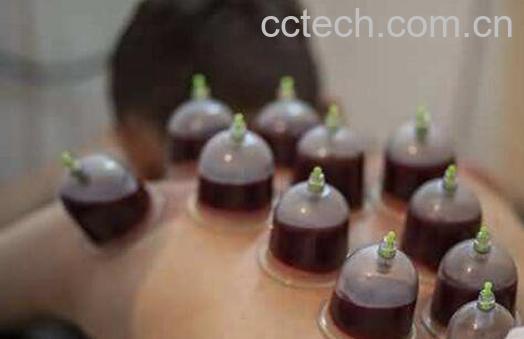 拔血罐的好处和坏处-0