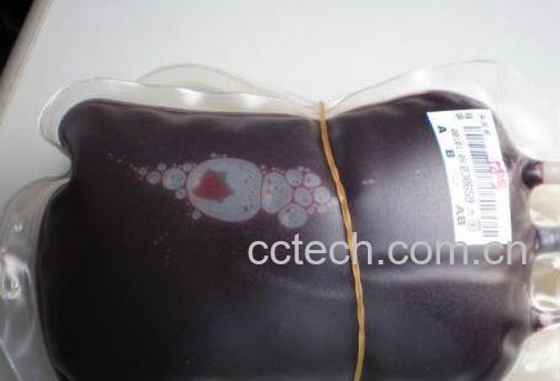 献血要求有哪些 哪些人不能献血-1