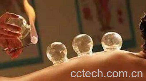 拔火罐的好处和坏处-1