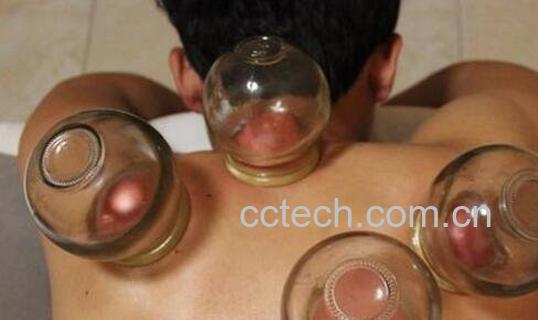拔罐的好处和坏处-0
