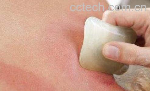 刮痧的好处和坏处-1