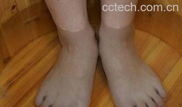 果蔬百科白醋泡脚能治脚气吗-0