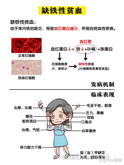 缺铁性贫血的症状有哪些 缺铁性贫血有什么危害