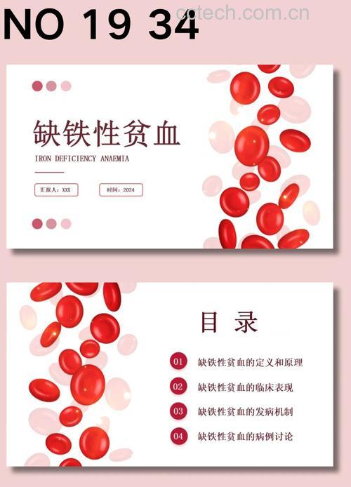 缺铁性贫血PPT课件内容有哪些?