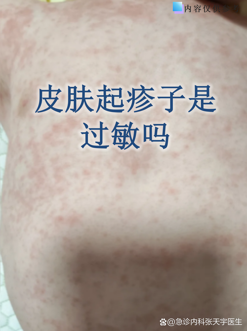 喝木瓜汁皮肤痒是怎么回事？木瓜汁过敏吗