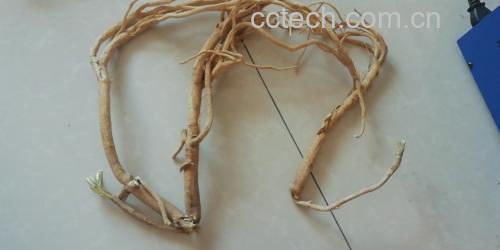 肺部结构与肺结节示意图